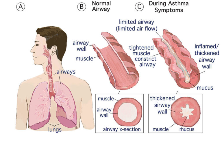 Ep. 8: Asthma And 'iggy And The Inhalers' - The Storytime Clinic